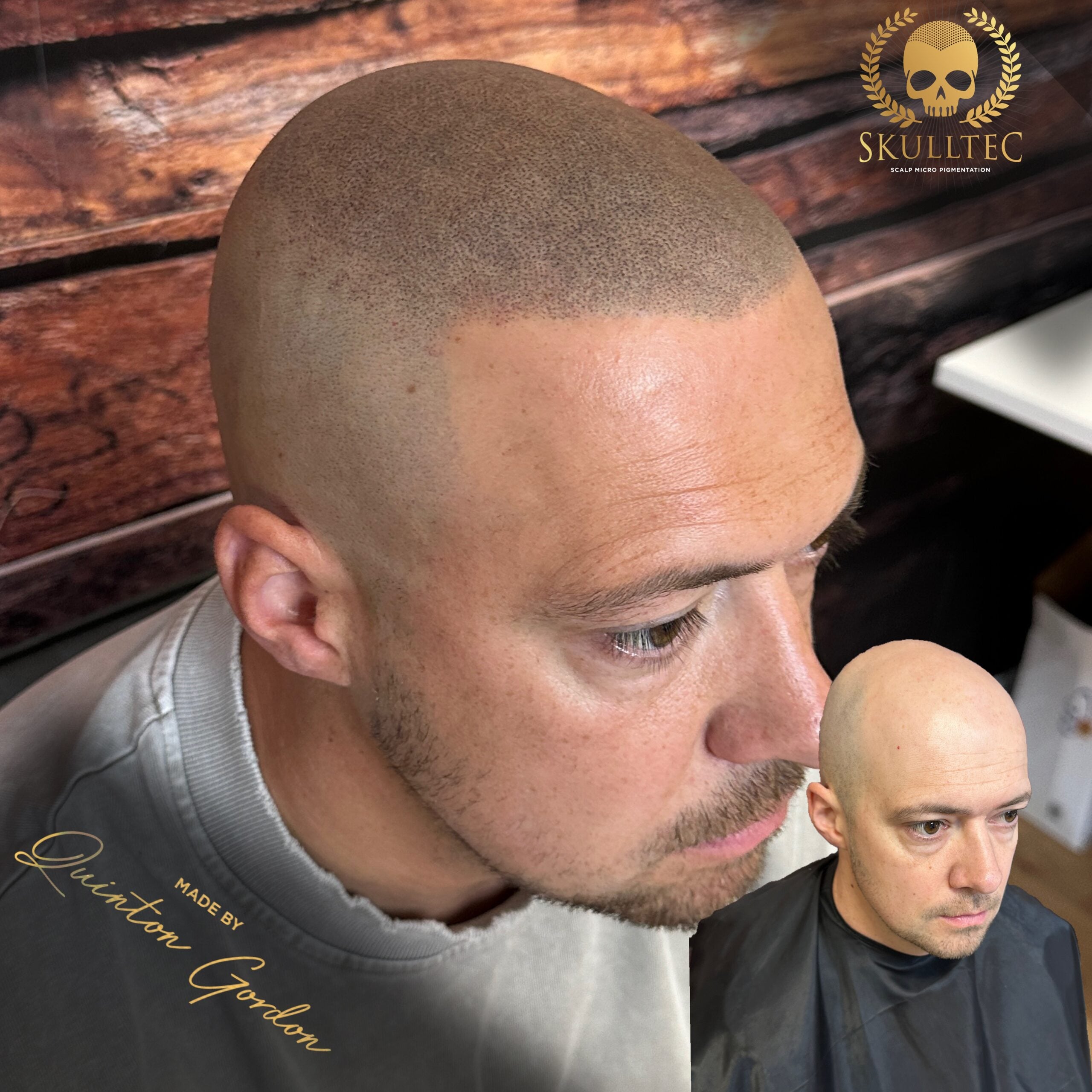 Skulltec - Hairloss 07349c2d d9b9 4a71 8df2 c68474fcf7f7