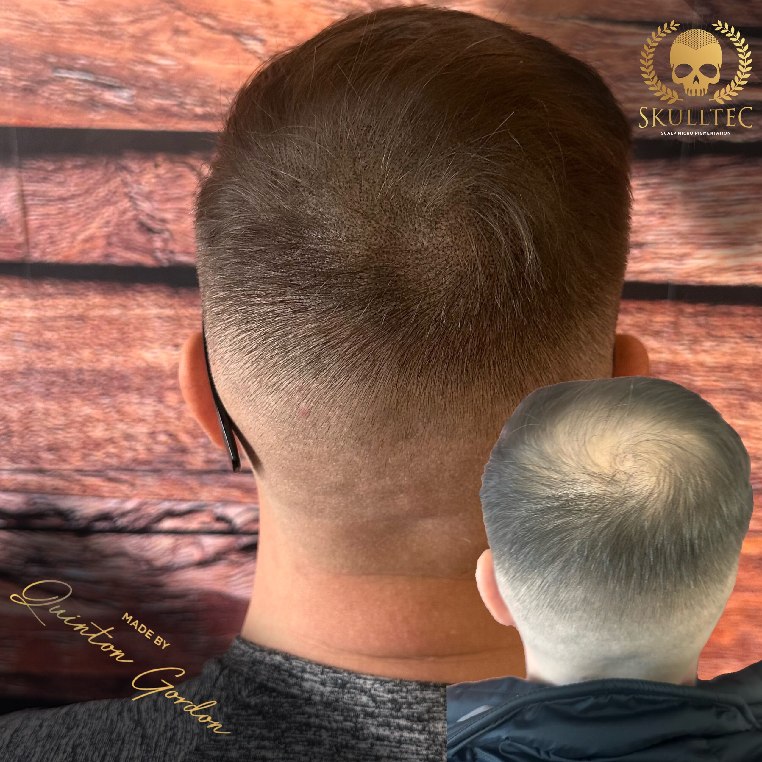 Skulltec - Hairloss c770de81 7f84 4827 af3d b67caed5b3f2