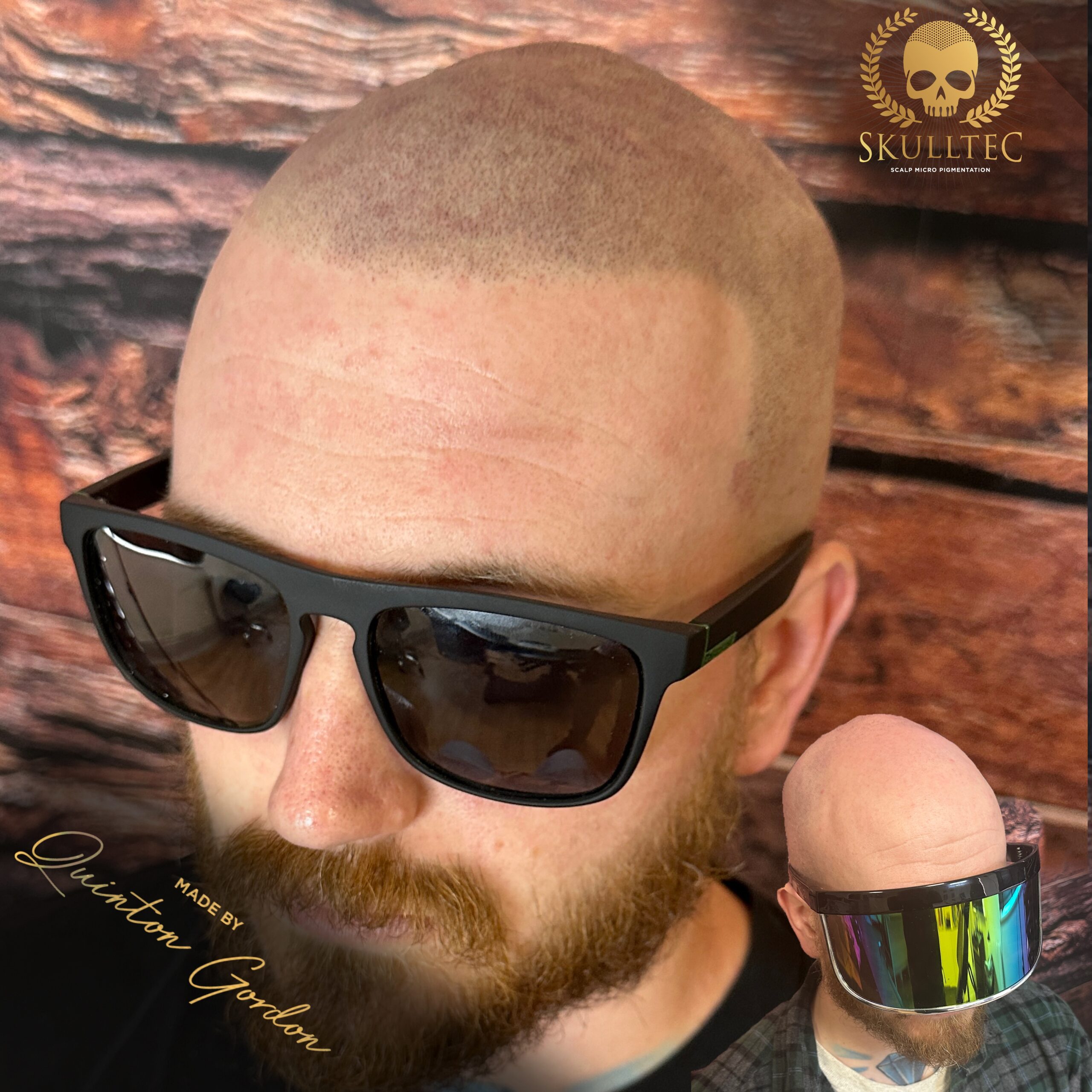 Skulltec - Hairloss dee3ac7f 8f90 4499 925c 79b735aa33c6