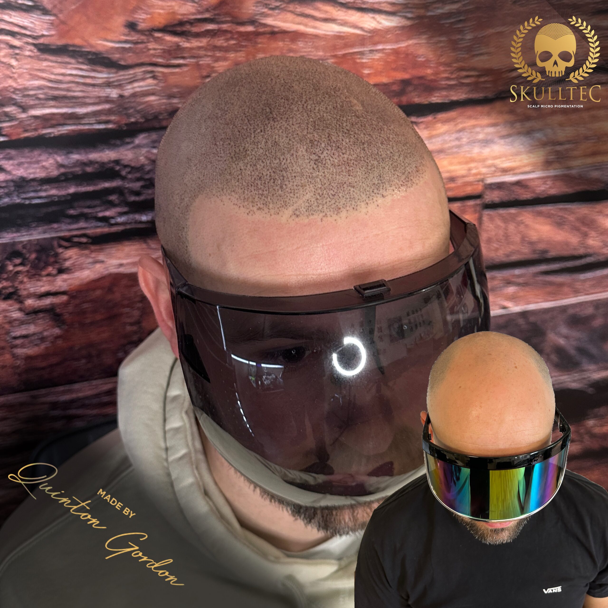 Skulltec - Hairloss fa3b6ba0 30f2 4f45 a8fa a19767232c14