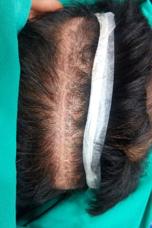 scar image 533x800