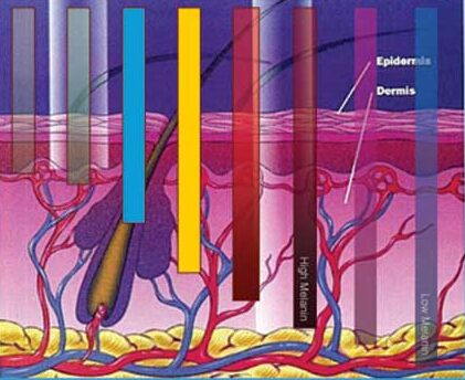 laser penetration med